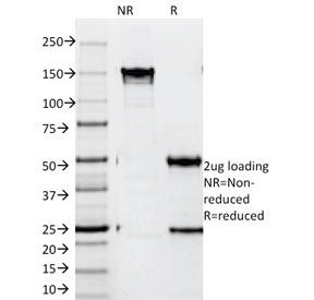 SDS-PAGE analysis of purified, BSA-free ZAP70 Antibody / Immune Tolerance Signaling Antibody (clone SPM362) as confirmation of integrity and purity.