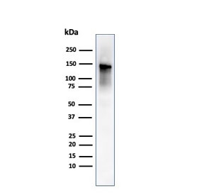 Caldesmon Antibody for WB / CALD1 Western Blot Antibody (clone rCALD1/820). Western blot analysis of Caldesmon (CALD1) in human ovary tissue lysate. Lane 1: human ovary tissue lysate. A band is detected at approximately 120-150 kDa, consistent with the predicted molecular weight of Caldesmon / CALD1 and representing the high molecular weight smooth muscle-associated h-caldesmon isoform. CALD1 is known to produce multiple isoforms, with lower molecular weight forms typically observed at approximately 70-80 kDa in non-muscle cells, while the higher molecular weight isoform predominates in smooth muscle tissues. The observed band pattern reflects known CALD1 isoform-dependent migration behavior in western blot analysis.