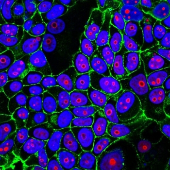Cyclin B1 Antibody IF. Immunofluorescent staining of human MCF7 cells using Cyclin B1 Antibody / Cell Cycle Regulator Antibody (clone CCNB1/1098) demonstrates prominent red fluorescence localized predominantly within cell nuclei, consistent with Cyclin B1 expression in actively cycling cells. Cyclin B1 is a key regulator of G2/M phase progression and forms a functional complex with CDK1 to control entry into mitosis. The observed nuclear staining pattern is consistent with the role of Cyclin B1 in regulating cell cycle progression and mitotic activity. CF488-conjugated phalloidin (green) highlights the actin cytoskeleton and cell boundaries, while Hoechst stain (blue) identifies cell nuclei. Red = Cyclin B1 antibody; Green = actin cytoskeleton; Blue = nuclei.