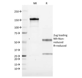 SDS-PAGE analysis of purified, BSA-free CD1A antibody (clone CBT6) as confirmation of integrity and purity.