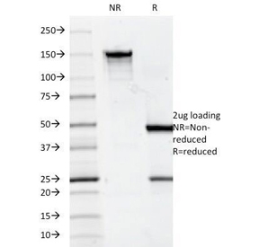 CD7 Antibody Clone 124-1D1 SDS-PAGE. SDS-PAGE analysis of purified, BSA-free CD7 antibody clone 124-1D1 under non-reducing (NR) and reducing (R) conditions shows expected banding patterns consistent with intact immunoglobulin, with a predominant band at approximately 150 kDa in non-reducing conditions and bands at approximately 50 kDa and 25 kDa under reducing conditions corresponding to heavy and light chains, confirming antibody integrity and purity.