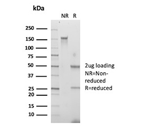 CD7 Antibody Clone T3-3A1 SDS-PAGE. SDS-PAGE analysis of purified CD7 antibody clone T3-3A1 under non-reducing (NR) and reducing (R) conditions shows expected immunoglobulin banding patterns, with a predominant band at approximately 150 kDa in non-reducing conditions and bands at approximately 50 kDa and 25 kDa under reducing conditions corresponding to heavy and light chains, confirming antibody purity and structural integrity.