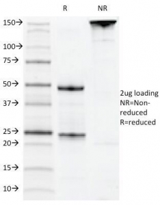SDS-PAGE Analysis of Purified, BSA-Free CD22 Antibody / B Cell Malignancy Research Antibody Clone MYG13. Confirmation of Integrity and Purity of the Antibody.
