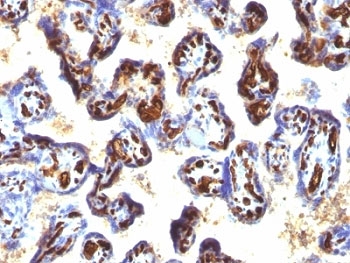 IHC: Formalin-fixed, paraffin-embedded human placenta stained with CD34 antibody (QBEnd/10 + HPCA1/763)