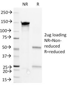 SDS-PAGE Analysis of Purified, BSA-Free CD36 Antibody 1E8. Confirmation of Integrity and Purity of the Antibody.