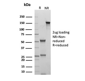 SDS-PAGE Analysis of Purified CD70 Antibody Mouse Monoclonal (clone TNFS7/1026). Confirmation of Purity and Integrity of Antibody.