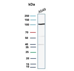 Western blot testing of A549 cell lysate with Major Vault Protein antibody (clone 1014). Observed molecular weight: 104~110 kDa.