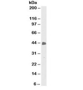 Western blot testing of HeLa cell lysate with Cytokeratin 8/18 antibody (clone C-51). Predicted molecular weight: ~53/48kDa (CK8/CK18), observed here at ~43kDa.