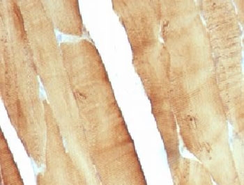 IHC: Formalin-fixed, paraffin-embedded rat skeletal muscle stained with pan Muscle Actin antibody (clone MSA/953).