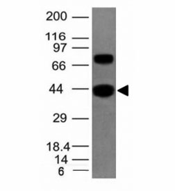 Western blot of human skeletal muscle tissue lysate using pan Muscle Actin antibody (clone MSA/953).
