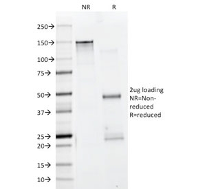 SDS-PAGE analysis of purified, BSA-free pan Muscle Actin antibody cocktail antibody (clone HHF35 + MSA/953) as confirmation of integrity and purity.