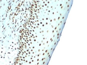Nuclear Antigen Antibody Tonsil IHC. Immunohistochemistry staining of FFPE human tonsil tissue using Nuclear Antigen Antibody / Pan-Nuclear Marker Antibody (clone NM106) demonstrates strong nuclear HRP-DAB brown staining throughout lymphoid cell populations. The staining pattern is consistent with recognition of a broadly expressed nuclear-associated antigen present within the nuclei of both normal and proliferating cells. Uniform nuclear localization provides clear delineation of cellular distribution and tissue architecture while surrounding non-nuclear compartments remain unstained. As a pan-nuclear marker, clone NM106 is useful for visualization of nuclei, assessment of tissue organization, and subcellular localization studies in both normal and pathological specimens. The observed staining highlights the widespread expression of the target nuclear antigen throughout tonsillar lymphoid tissue.