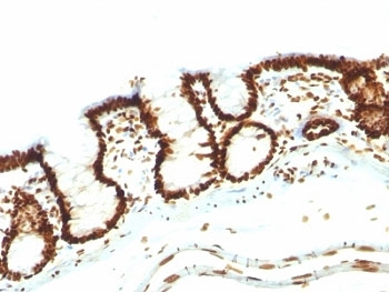 Nuclear Antigen Antibody Rat Colon IHC. Immunohistochemistry staining of FFPE rat colon tissue using Nuclear Antigen Antibody / Pan-Nuclear Marker Antibody (clone NM106) demonstrates strong nuclear HRP-DAB brown staining throughout the epithelial cells lining the colonic mucosa. The staining pattern is consistent with recognition of a broadly expressed nuclear-associated antigen present within the nuclei of diverse cell types. Prominent nuclear localization sharply defines the epithelial architecture of the colonic glands and surface mucosa while providing clear visualization of cellular distribution within the tissue. As a pan-nuclear marker, clone NM106 is useful for identification of nuclei, assessment of tissue morphology, and subcellular localization studies in normal and pathological specimens. The observed staining highlights robust nuclear labeling of the colonic epithelial compartment with minimal non-nuclear background.