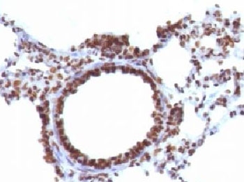 Nuclear Antigen Antibody Rat Lung IHC. Immunohistochemistry staining of FFPE rat lung tissue using Nuclear Antigen Antibody / Pan-Nuclear Marker Antibody (clone NM106) demonstrates strong nuclear HRP-DAB brown staining throughout the pulmonary cellular compartment, including bronchial epithelial cells and cells within the surrounding alveolar tissue. The staining pattern is consistent with recognition of a broadly expressed nuclear-associated antigen present within the nuclei of diverse cell types. Distinct nuclear localization provides excellent visualization of cellular distribution and tissue architecture while minimizing cytoplasmic background staining. As a pan-nuclear marker, clone NM106 is useful for identification of nuclei, assessment of tissue morphology, and subcellular localization studies in both normal and experimental tissue specimens. The observed staining highlights robust and widespread nuclear labeling throughout rat lung tissue.