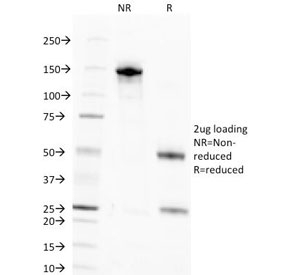 SDS-PAGE analysis of purified, BSA-free Nuclear Antigen antibody (clone NM106) as confirmation of integrity and purity.