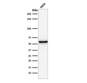 Western blot testing of human HeLa cell lysate with anti-Mitochondrial antibody (clone AE-1).