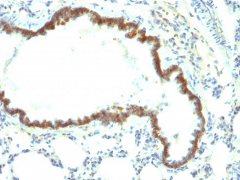 Rat EpCAM Antibody Lung IHC. Formalin-fixed, paraffin-embedded rat lung stained with EpCAM antibody (clone Epcam/1158).