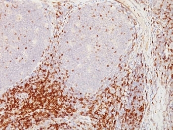 CD5 Antibody Clone CD5/54F6. Immunohistochemistry analysis of CD5 antibody staining in formalin-fixed, paraffin-embedded human tonsil tissue using a T cell marker antibody. Clone CD5/54F6 shows strong membranous staining of T lymphocytes within interfollicular regions, with dense labeling of T cell zones surrounding germinal centers, while follicular B cell areas remain largely negative. The staining pattern highlights normal tonsillar architecture and clearly delineates T cell-rich compartments, consistent with the established role of CD5 as a marker of mature T lymphocytes in lymphoid tissue.