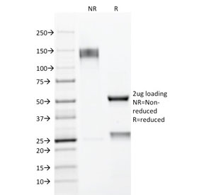 SDS-PAGE analysis of purified, BSA-free MUC1 antibody (clone E29) as confirmation of integrity and purity.