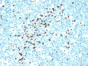 IHC: Formalin-fixed, paraffin-embedded human tonsil stained with IgM antibody (clone DA4-4).