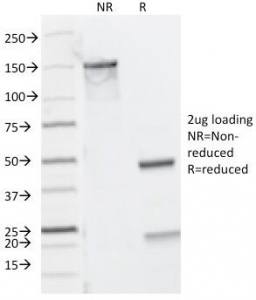 SDS-PAGE Analysis of Purified, BSA-Free CD8A Antibody / Lymphocyte Surface Marker Antibody (clones C8/468 + C8/144B). Confirmation of Integrity and Purity of the Antibody.