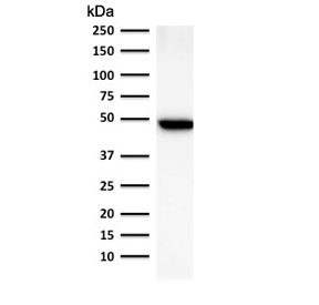 Western blot testing of human lung lysate with Keratin 19 antibody (clone BA17). Predicted molecular weight ~43 kDa.