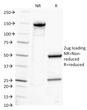 SDS-PAGE Analysis of Purified, BSA-Free IgG Antibody clone IG217. Confirmation of Integrity and Purity of the Antibody.