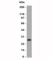 Western blot of human Intestinal lysate using Lambda Light Chain antibody (HP6054).