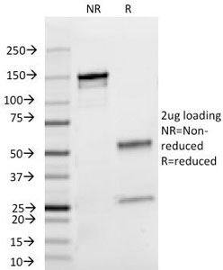 SDS-PAGE Analysis of Purified, BSA-Free Lambda Light Chain Antibody (clone HP6054). Confirmation of Integrity and Purity of the Antibody.
