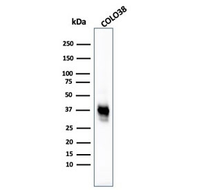 Melanoma Cell Marker Antibody Cocktail WB. Western blot testing of human COLO-38 cell lysate with Melanoma Cell Marker antibody cocktail (clones M2-7C10 + M2-9E3 + HMB45 + T311).