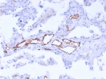 IHC staining of FFPE human uterus with von Willebrand Factor antibody cocktail. HIER: boil tissue sections in pH9 EDTA buffer, for 20 min and allow to cool before testing.