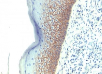 Formalin-fixed, paraffin-embedded human skin stained with E-Cadherin antibody (CDH1/1525).