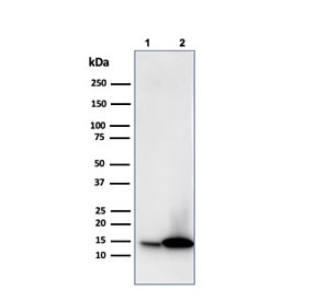 Galectin 1 Antibody Human JEG-3 and K562 WB. Western blot analysis of 1) human JEG-3 and 2) human K562 cell lysates using Galectin 1 antibody (clone GAL1/1831). A strong, distinct band is detected at approximately 14 kDa in both cell lines, consistent with the expected molecular weight of Galectin-1 (LGALS1), a beta-galactoside-binding lectin involved in immune regulation, cell adhesion, angiogenesis, and tumor microenvironment signaling. The results demonstrate specific detection of endogenous Galectin-1 protein and support the utility of clone GAL1/1831 for western blot applications. Predicted molecular weight: ~14 kDa.
