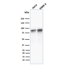 Western blot testing of human 1) HeLa and 2) SK-BR-3 cell lysate with Plakoglobin antibody (clone 11E4). Predicted molecular weight: 80-87 kDa.