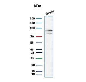 Beta-Catenin Consistency Antibody Brain WB. Western blot analysis of human brain tissue lysate using Beta-Catenin Antibody (clone 12F7) detects a clear band at approximately 90-95 kDa, consistent with the predicted molecular weight of Catenin beta-1 / CTNNB1 at ~85 kDa with a characteristic upward shift during SDS-PAGE. This migration pattern aligns with phosphorylation-associated modulation of beta-catenin mobility and supports reproducible detection of CTNNB1 in neural tissue.