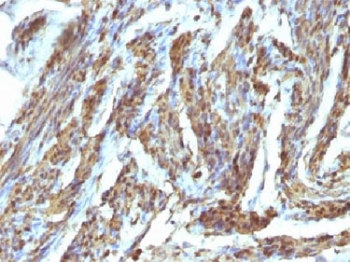 IHC testing of FFPE human uterus stained with Calponin antibody. HIER: steam sections in 10mM Tris with 1mM EDTA, pH 9.0, for 10-20 min.