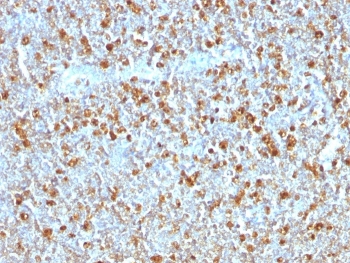 IHC testing of FFPE human tonsil with Alpha 1 Antitrypsin antibody (clone AAT/1379). Required HIER: steam sections in pH6, 10mM citrate buffer for 10-20 min.