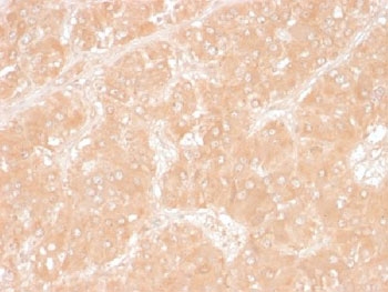 Perilipin 2 Antibody Adrenal Tissue IHC. Immunohistochemistry testing of FFPE human adrenal tissue with Perilipin 2 antibody (clone ADFP/1366). Required HIER: steam sections in pH6, 10mM citrate buffer for 10-20 min.