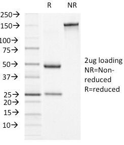 SDS-PAGE Analysis of Purified, BSA-Free Alpha-1-Antichymotrypsin Antibody (clone AACT/1451). Confirmation of Integrity and Purity of the Antibody.