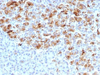 Alpha-1-Antichymotrypsin Antibody Pancreas Tissue Immunohistochemistry. IHC testing of FFPE human pancreas with Alpha-1-Antichymotrypsin antibody (clone AACT/1452). Required HIER: steam sections in pH6, 10mM citrate buffer for 10-20 min.