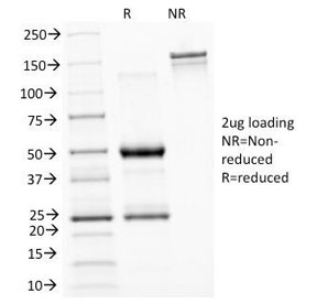 SDS-PAGE Analysis of Purified, BSA-Free ASRGL1 Antibody (clone CRASH/1289). Confirmation of Integrity and Purity of the Antibody.