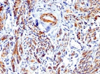 Caldesmon Antibody / CALD1 Cellular Morphology and Structural Integrity Protein Antibody. Immunohistochemistry analysis of Caldesmon (CALD1) in human uterus tissue. FFPE human uterus stained with Caldesmon Antibody demonstrates strong HRP-DAB brown cytoplasmic staining in smooth muscle cells of the myometrium. The staining highlights elongated, spindle-shaped cells arranged in organized bundles with continuous cytoplasmic signal, consistent with preservation of cellular morphology and structural integrity supported by stable actin filament networks. Surrounding stromal and epithelial compartments show minimal staining, reinforcing the role of CALD1 in maintaining cytoskeletal structure and cell shape. Heat-induced epitope retrieval was performed using EDTA buffer at pH 7.5-8.5.