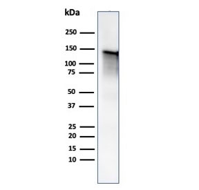 Caldesmon Antibody / CALD1 Cellular Morphology and Structural Integrity Protein Antibody. Western blot analysis of Caldesmon (CALD1) in human ovary tissue lysate. Lane 1: human ovary tissue lysate. A band is detected at approximately 120-150 kDa, consistent with the predicted molecular weight of Caldesmon / CALD1 and representing the high molecular weight h-caldesmon isoform associated with structurally stable smooth muscle cells. Additional lower molecular weight bands may be observed at approximately 70-80 kDa corresponding to non-muscle isoforms that contribute to maintenance of cellular morphology and cytoskeletal integrity. The observed banding pattern reflects isoform-dependent expression of CALD1 linked to preservation of cell shape and structural organization.