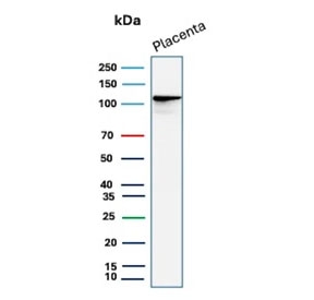 Western blot testing of human placental tissue lysate with E-Cadherin/Cadherin 1 antibody (clone 4A2). Expected molecular weight: 135 kDa (precursor), 80-120 kDa (mature, depending on glycosylation level).