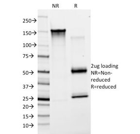 SDS-PAGE Analysis of Purified, BSA-Free von Willebrand Factor Antibody Clone F8/86 / VWF Antibody. Confirmation of Integrity and Purity of the Antibody.