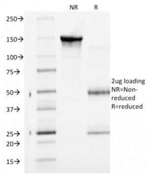 SDS-PAGE Analysis of Purified Gamma Catenin Antibody (clone CTNG/1664). Confirmation of Purity and Integrity of Antibody.