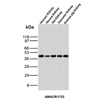 AMACR Antibody Kidney Tissue WB. Western blot analysis of human, mouse, rat, hamster, and guinea pig kidney tissue lysates using AMACR Antibody clone AMACR/1723 demonstrates a consistent band at approximately 40-42 kDa across all tested species, corresponding to the predicted molecular weight of Alpha-methylacyl-CoA racemase / AMACR. The conserved cross-species detection pattern supports recognition of this peroxisomal and mitochondrial enzyme involved in branched-chain fatty acid and bile acid metabolism.