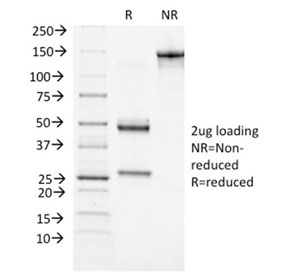 SDS-PAGE analysis of purified, BSA-free BRCA1 antibody (clone BRCA1/1472) as confirmation of integrity and purity.