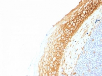 Beta Catenin Antibody Tonsil Immunohistochemistry. IHC testing of FFPE human tonsil tissue with Beta Catenin antibody (clone CTNNB1/1507). Required HIER: boil tissue sections in 10mM Tris with 1mM EDTA, pH 9.0, for 10-20 min.