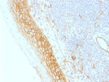 IHC testing of FFPE human tonsil tissue with b-Catenin antibody (clone CTNNB1/1509). Required HIER: boil tissue sections in 10mM Tris with 1mM EDTA, pH 9.0, for 10-20 min.